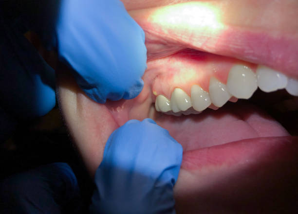 Best 24-Hour Emergency Dentist in Round Rock, TX